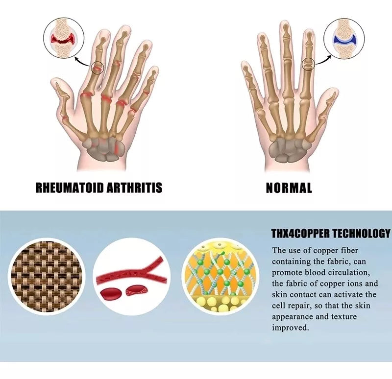 Guantes Compresión Túnel Carpiano y  Art